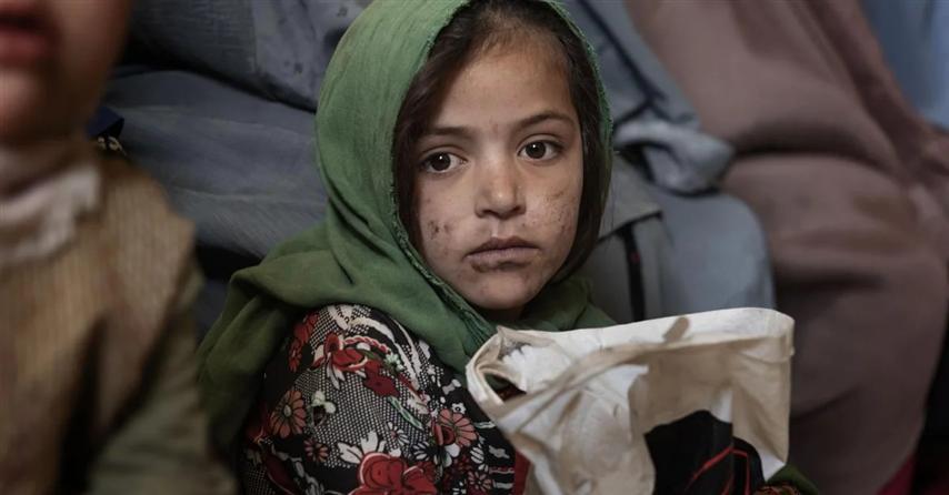 brote-de-colera-causa-12-muertos-en-afganistan