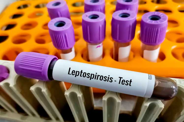 Tanzania-casos-leptospirosis