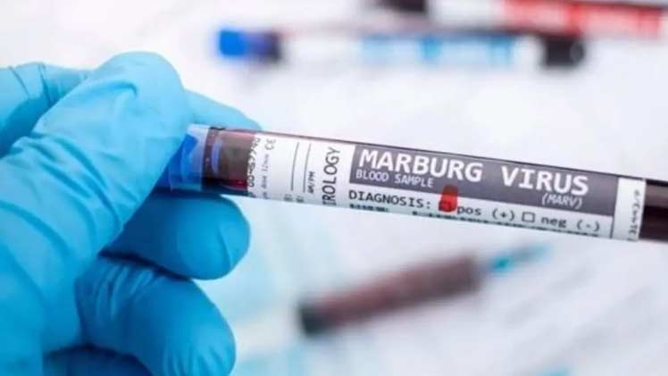 virus-Margburgo